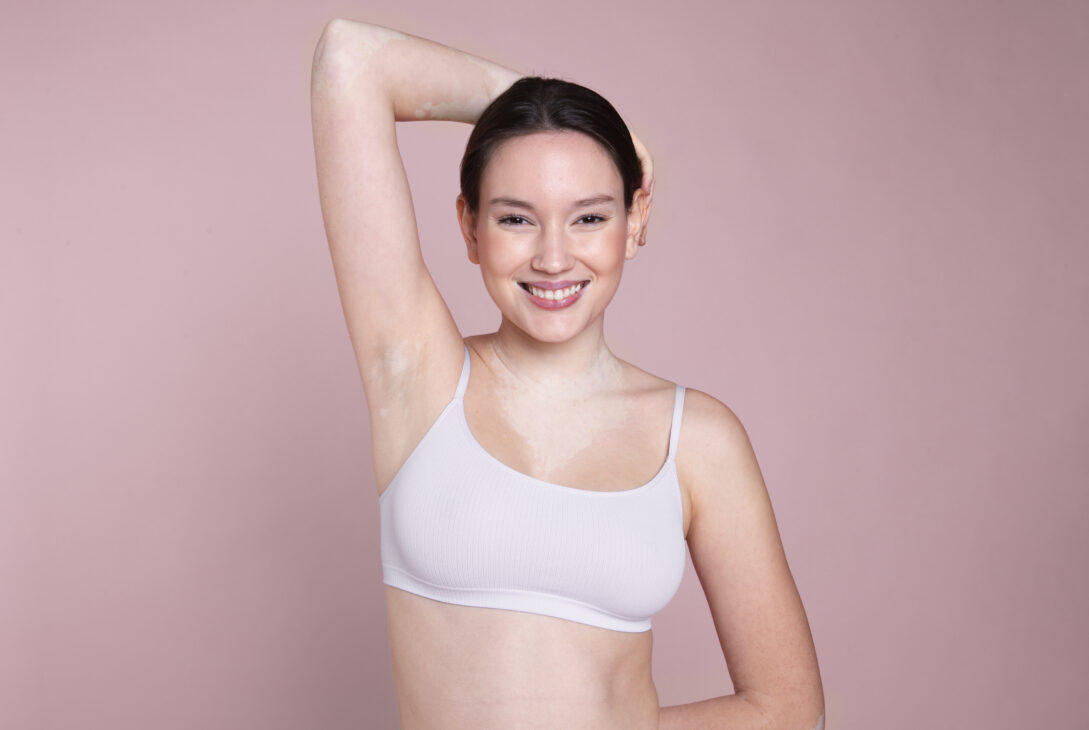 armpit rash